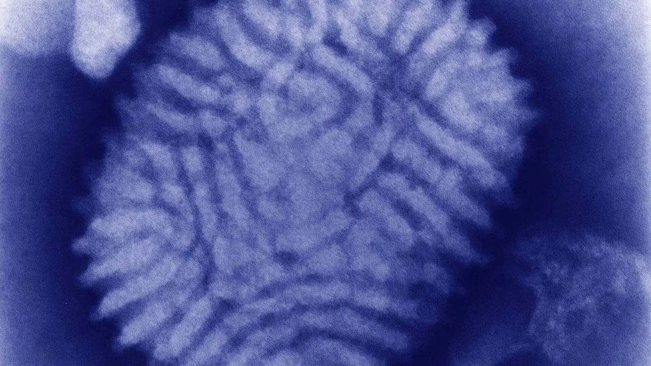 Myxoma virus (transmission electron microscope)