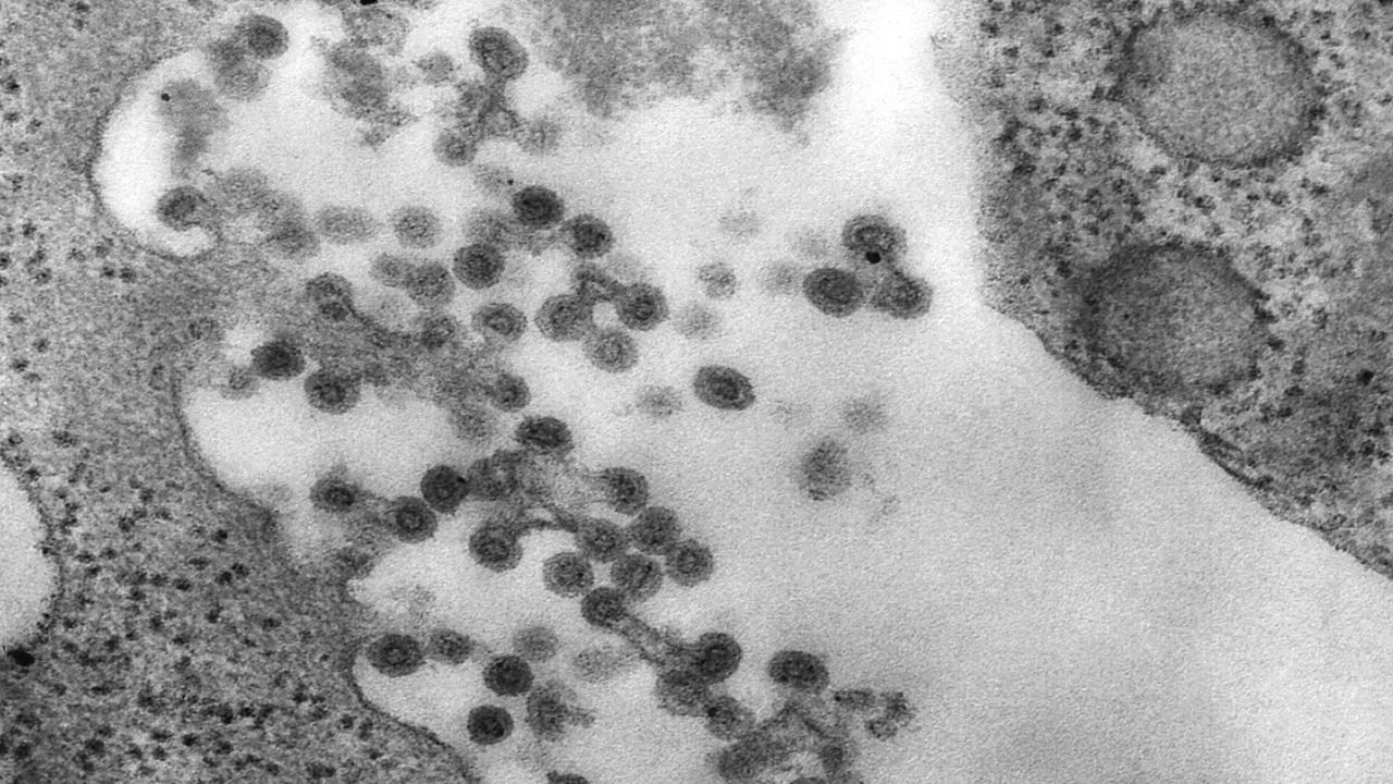 Rubella virus 10221 lores