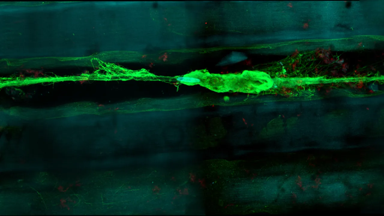Neuron in the microchannel of hydrogel implant