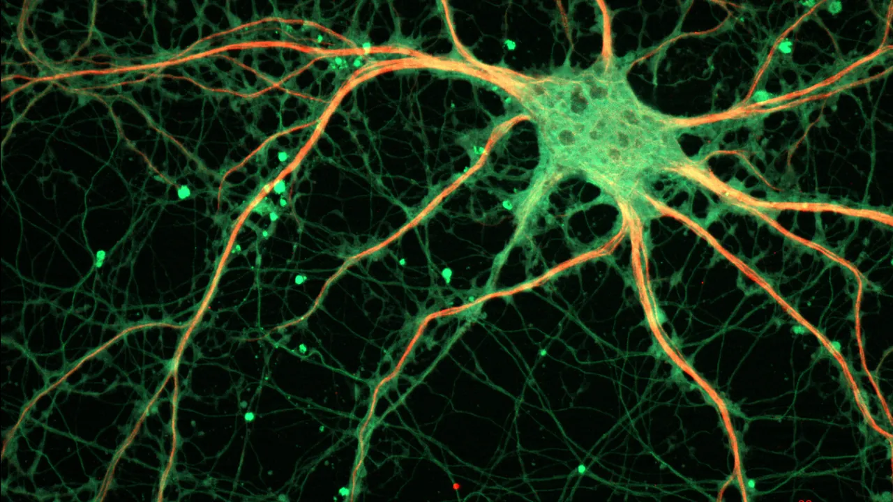 Cultured Rat Hippocampal Neuron (24327909026)