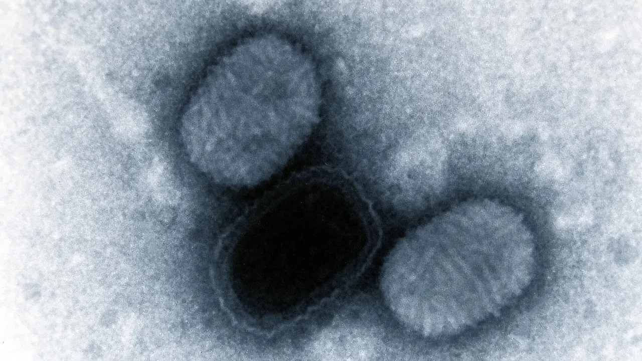 Molluscum contagiousum virus