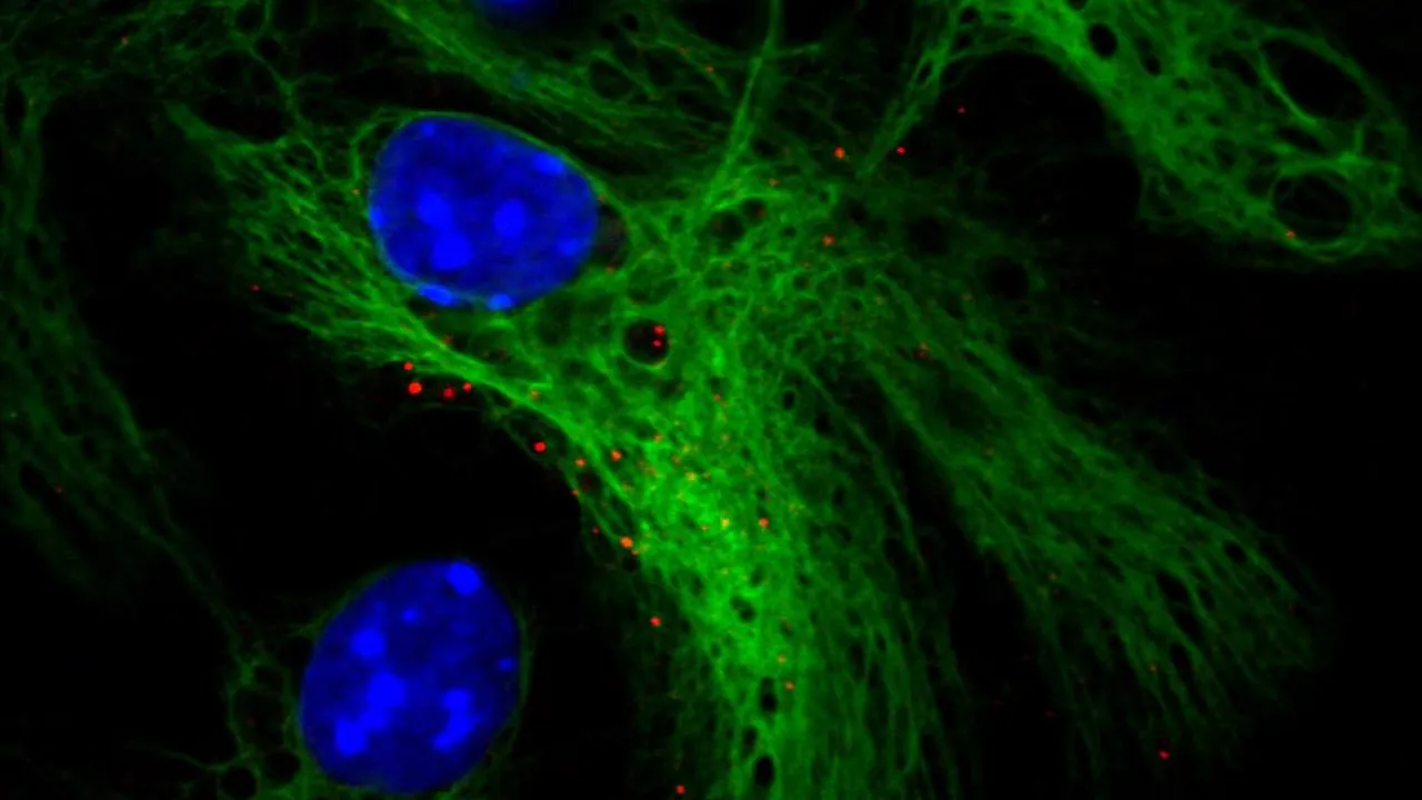 Neural Stem Cells and Growth Hormone Receptor