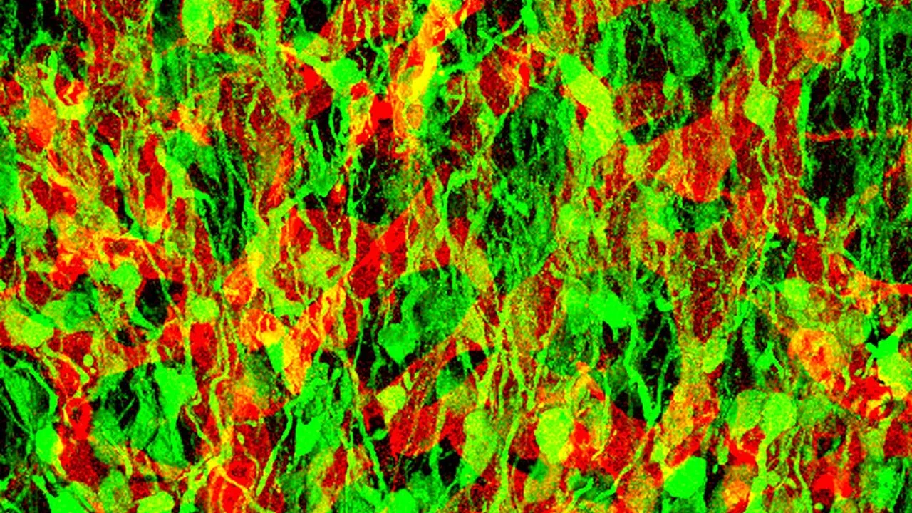 Neural stem-progenitor cells of the adult olfactory bulb