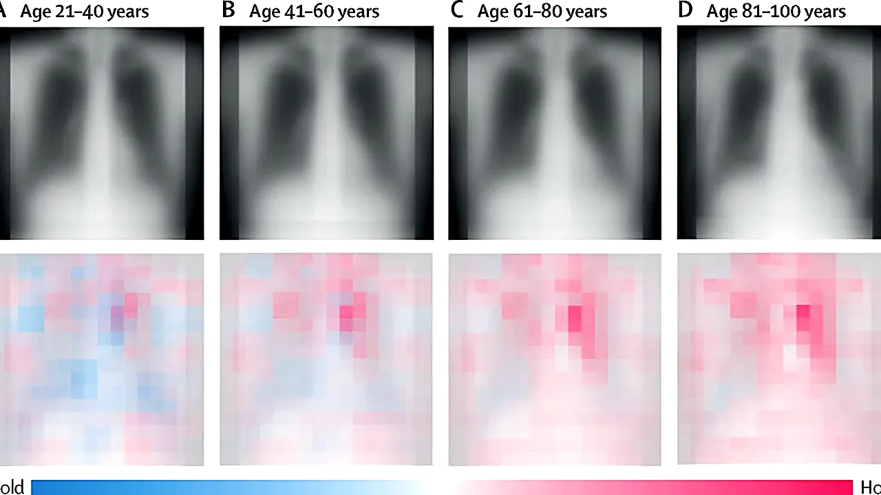Averaged chest radiographs for all participants and heatmap of regions' association with aging (saliency maps from the e