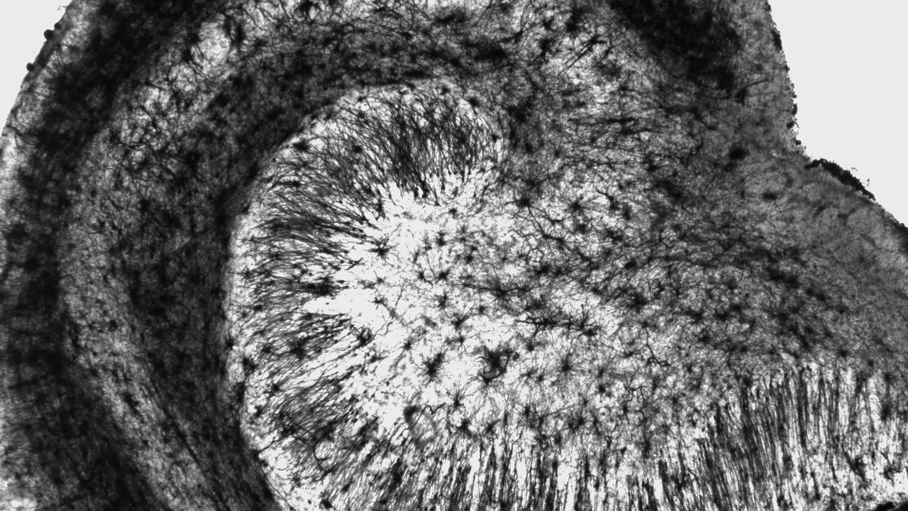 Human hippocampus 2.5x
