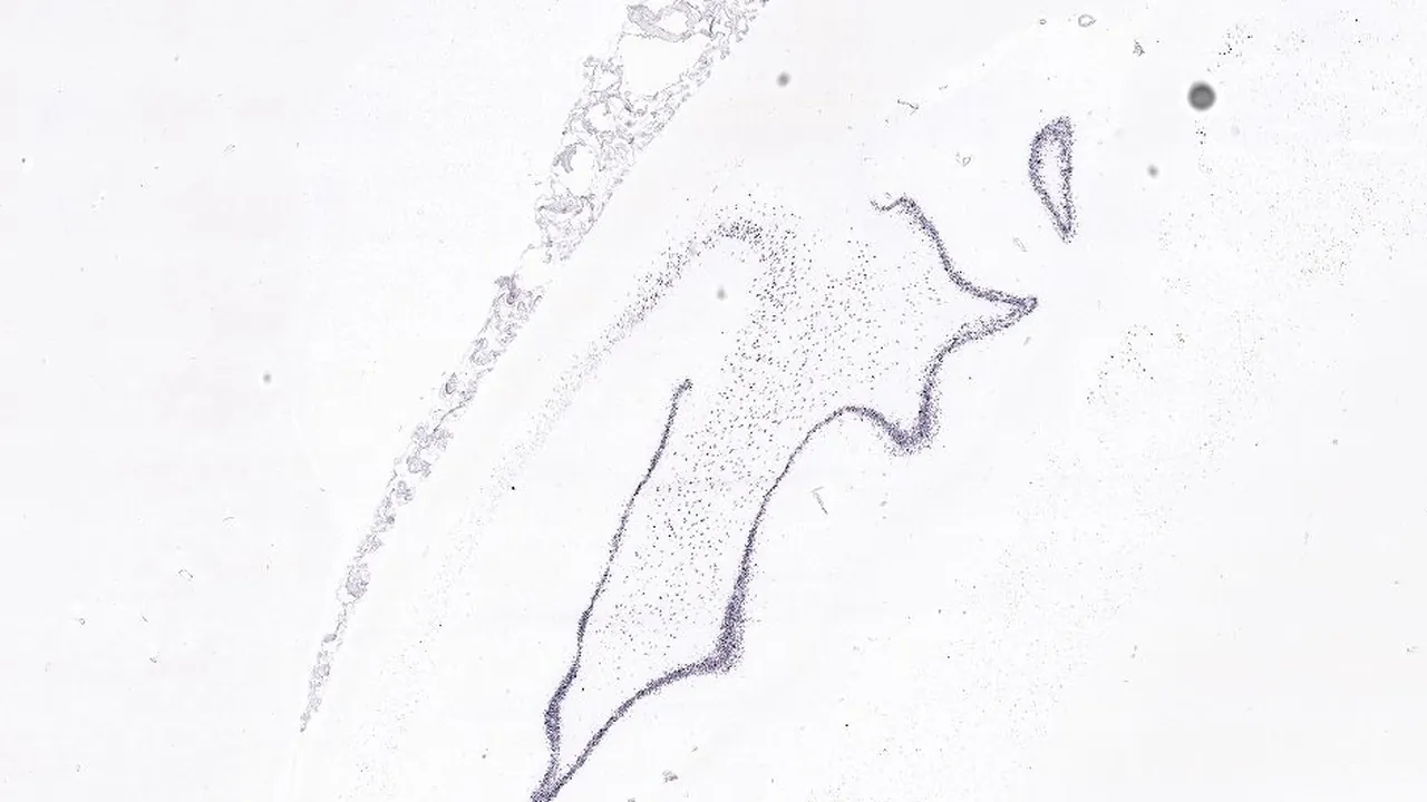 BDNF, adult human, hippocampus, ISH