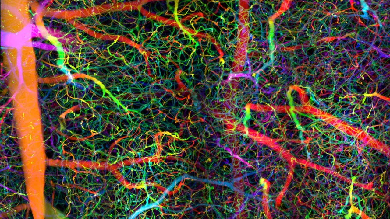 Blood vessels-MIP