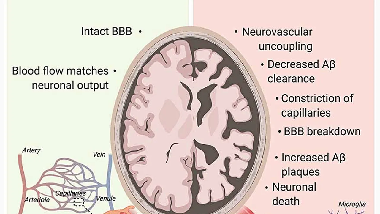 Pericytes’ role in Alzheimer’s disease (AD) pathogenesis