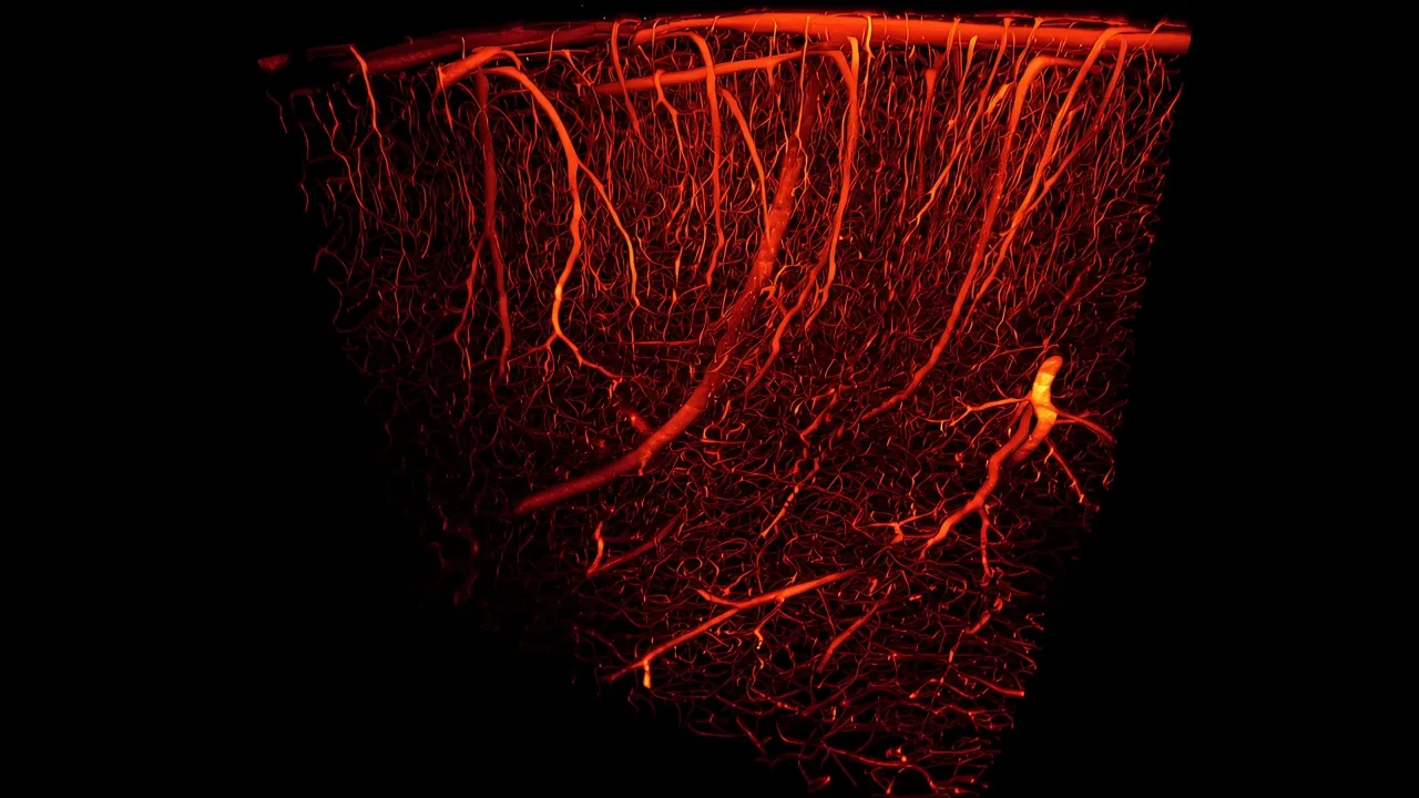 Blood vessels-3D rendering