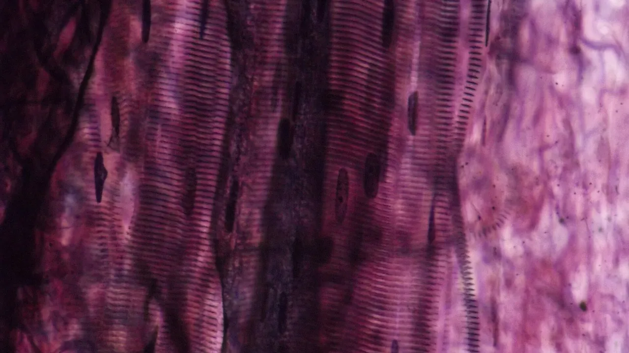 Aponeurosis fibra muscular
