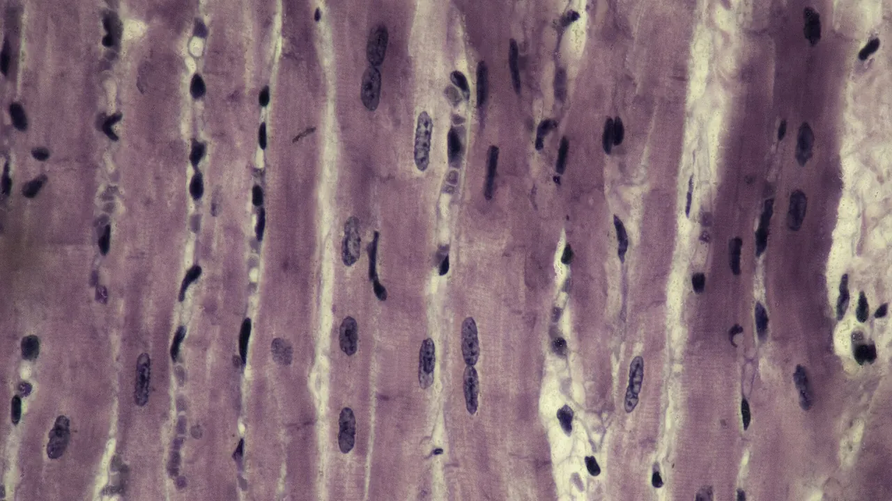 Cardiocyte (myocyte)