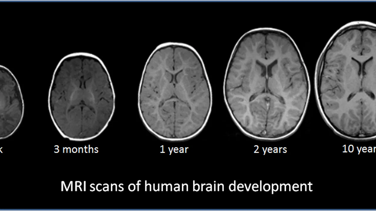 Human brain development 1wk-3mo-1yr-2yr-10yr-T1W-MRI