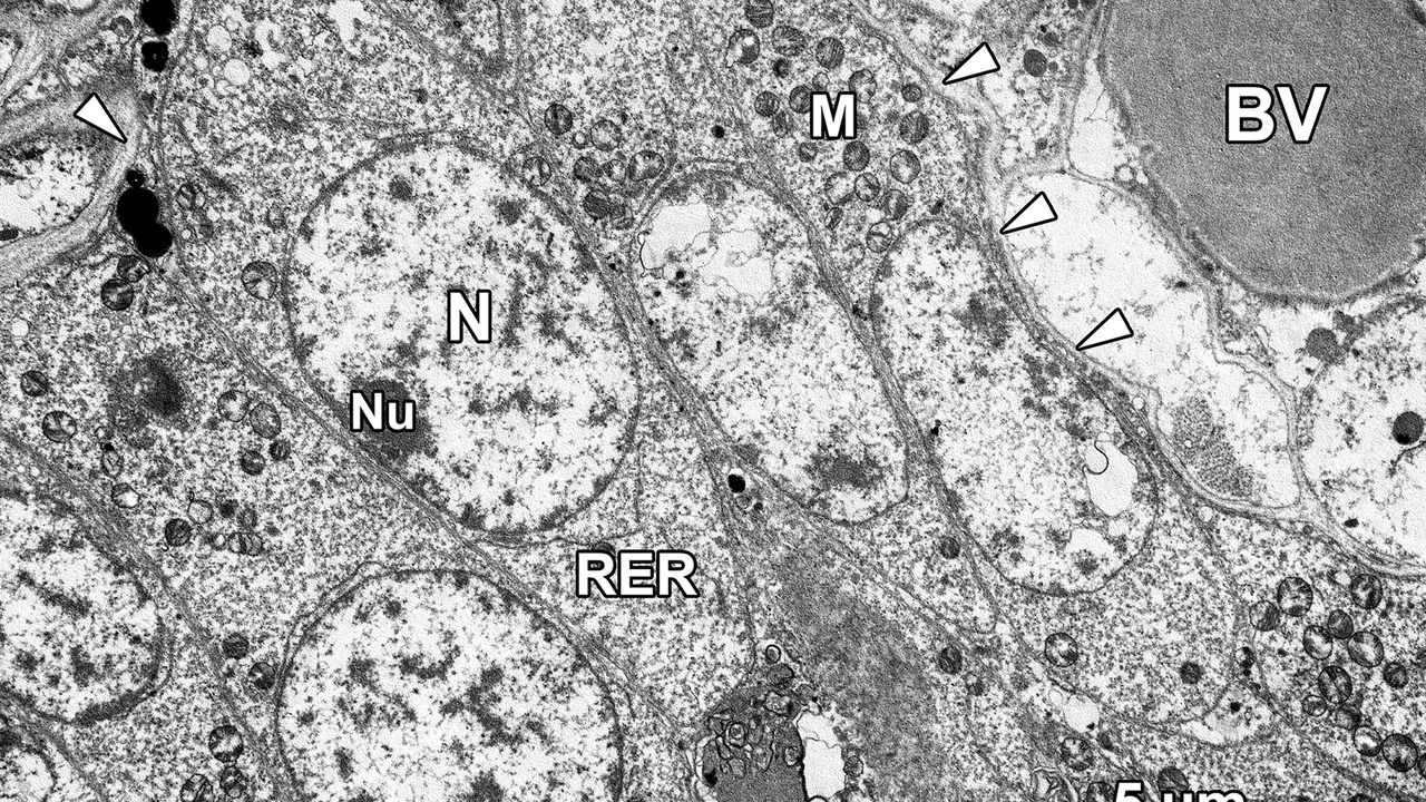 A transmission electron micrograph showing a layer of type A spermatogonia packed along the basement membrane (arrowhead