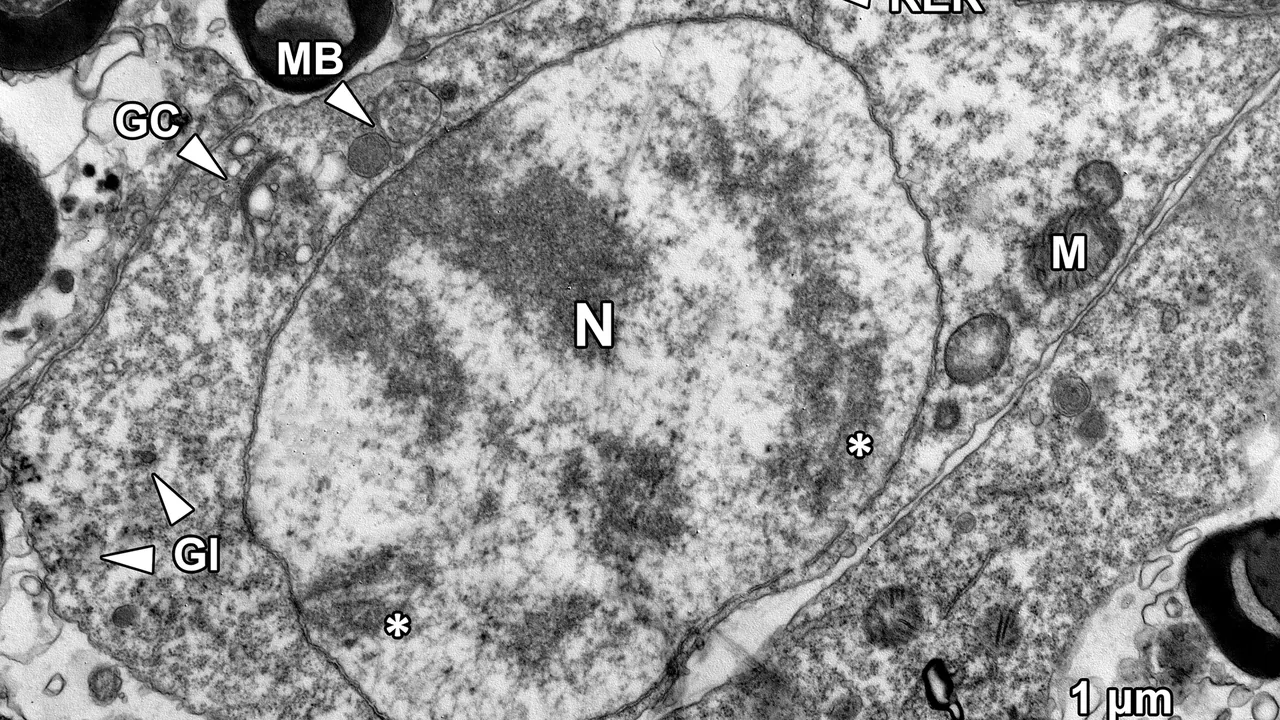 A transmission electron micrograph showing a primary spermatocyte at late zygotene-early pachytene stage of the first me