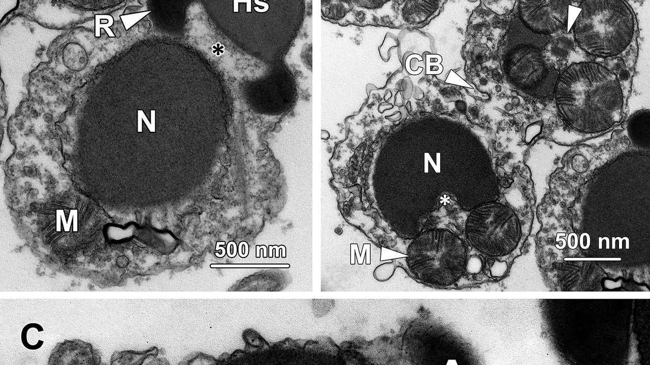 Transmission electron micrographs of step 10 spermatids