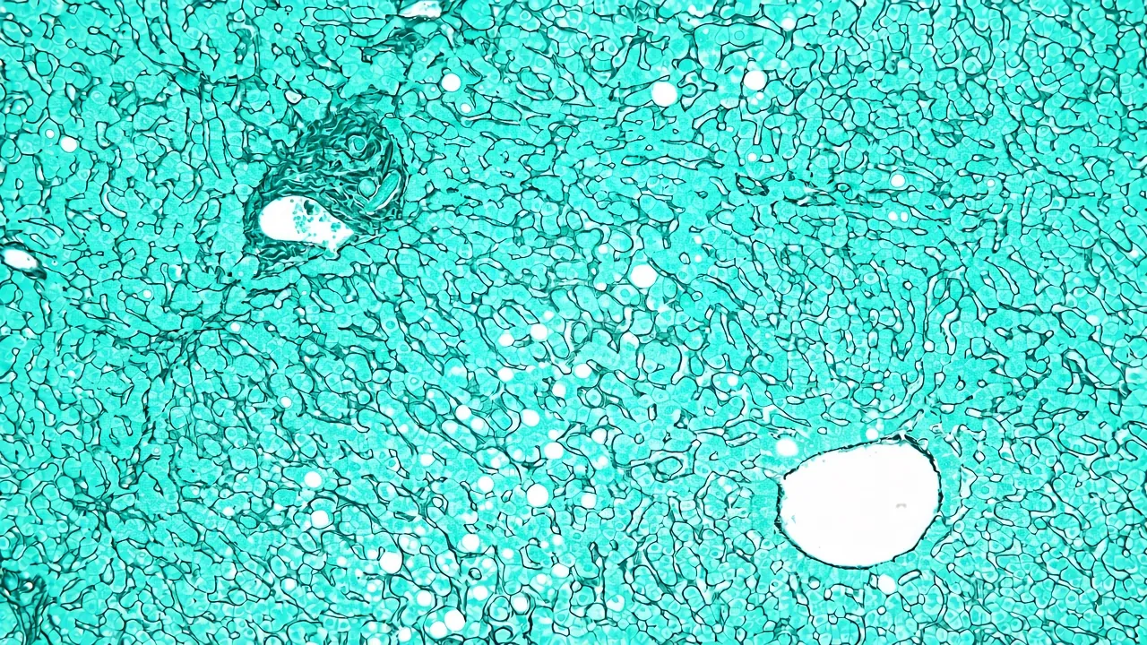 Liver reticulin