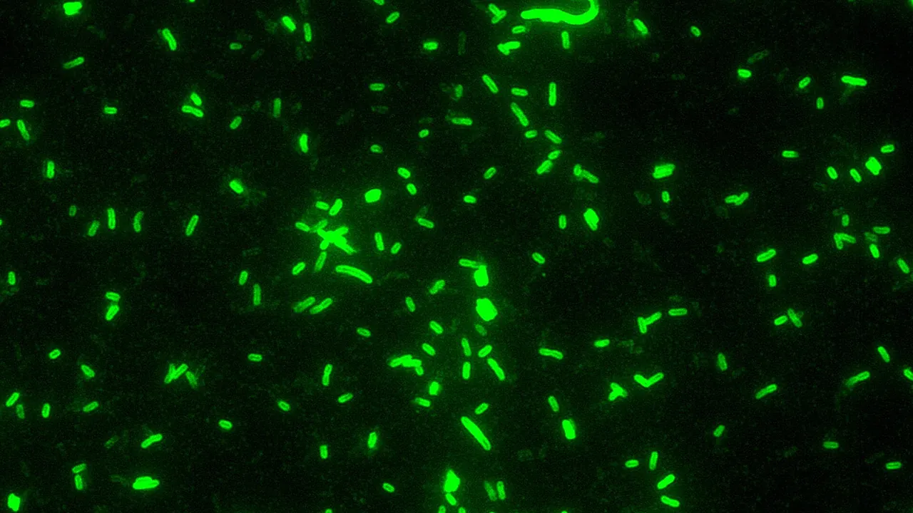 Yersinia pestis fluorescent - PHIL 1917