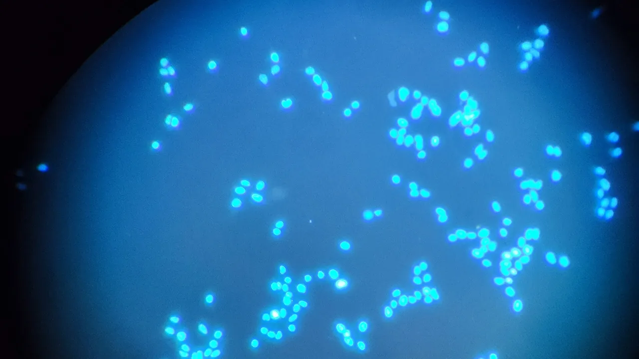 Fluorescence microscopy of the DNA of the oral cancer cells
