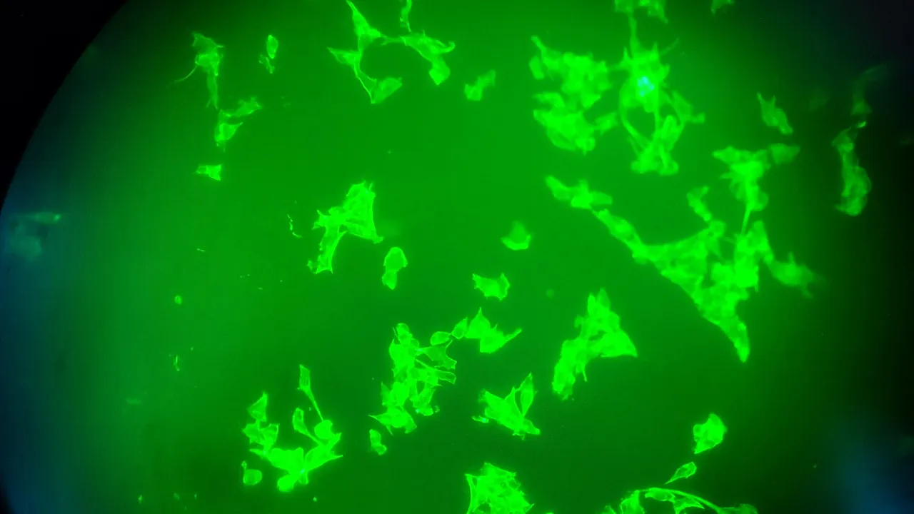 Fluorescence microscopy of the oral cancer cells