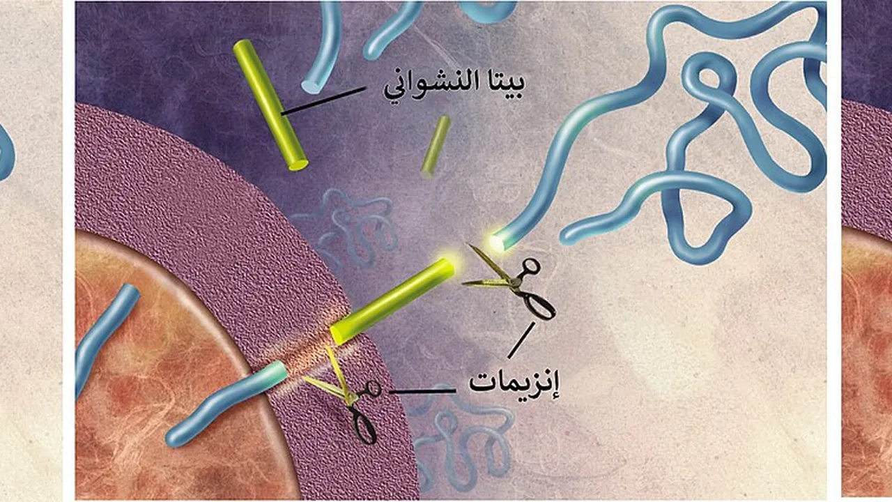 Amyloid-plaque formation-big-ar