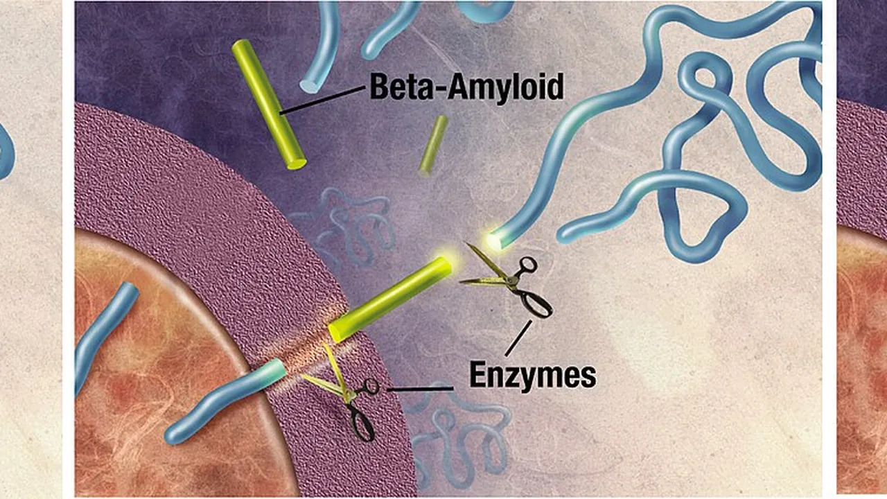 Amyloid-plaque formation-big