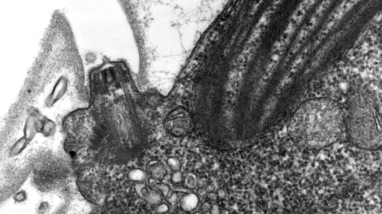 Chlamydomanas reinhardtii Flagella 6 - TEM