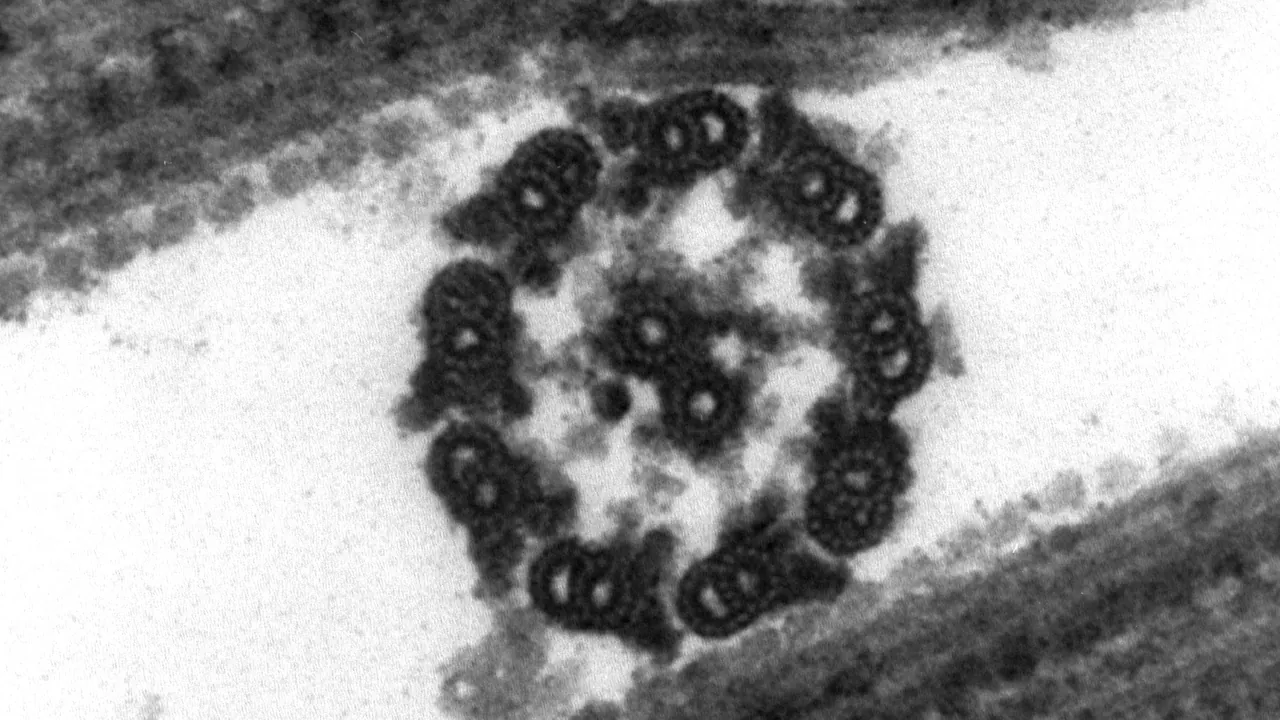Chlamydomanas reinhardtii Flagella 9 - TEM