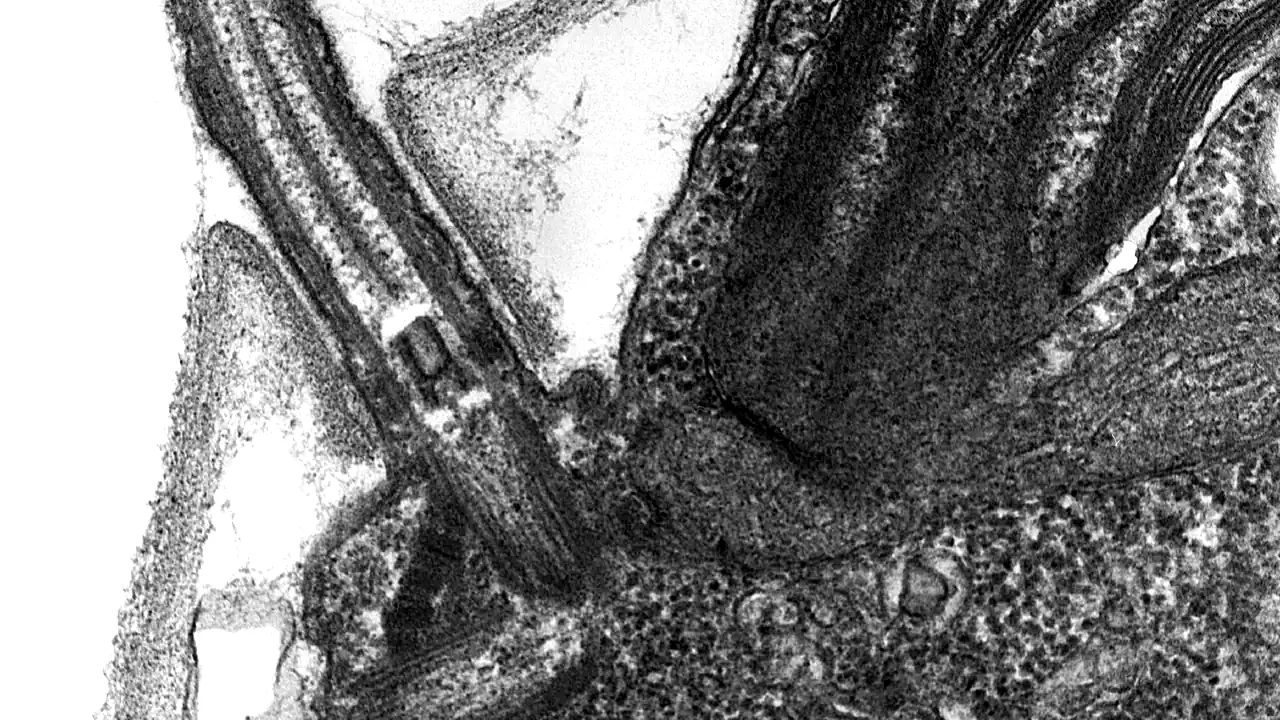 Chlamydomanas reinhardtii Flagella 5 - TEM