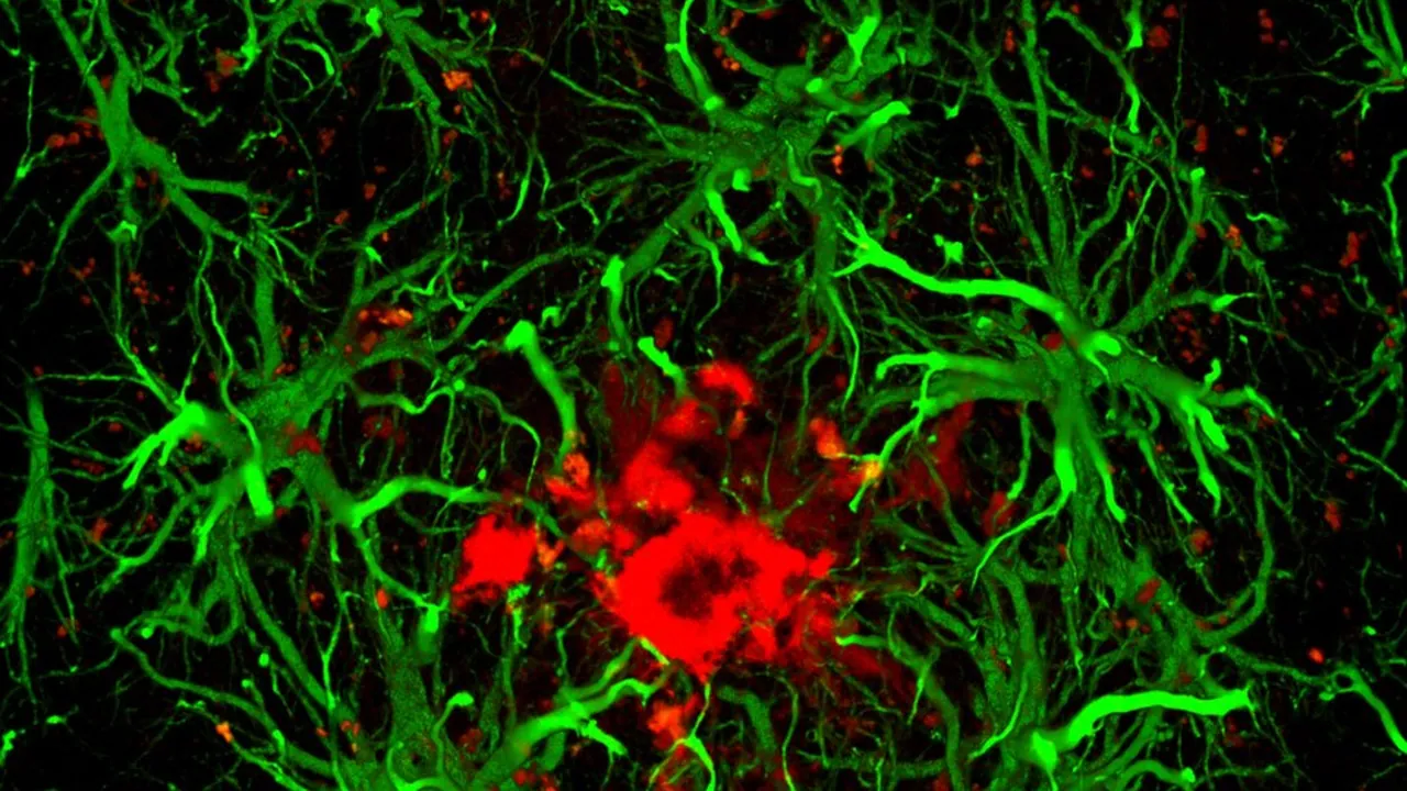 Astrocytes attracted by an amyloid plaque