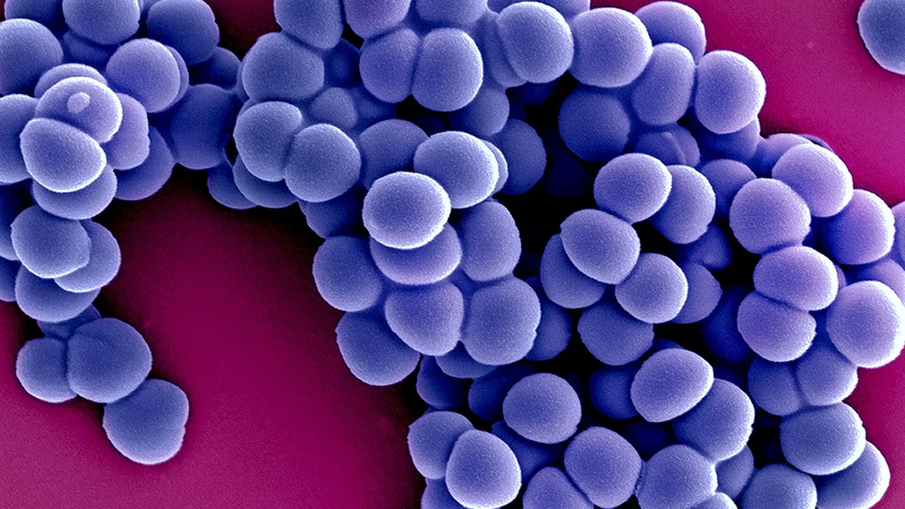 Methicillin-Resistant Staphylococcus Aureus (MRSA) Bacteria colorized scanning electron micrograph - 11