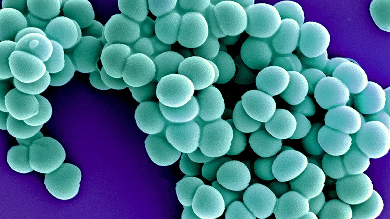 Methicillin-Resistant Staphylococcus Aureus (MRSA) Bacteria colorized scanning electron micrograph - 22