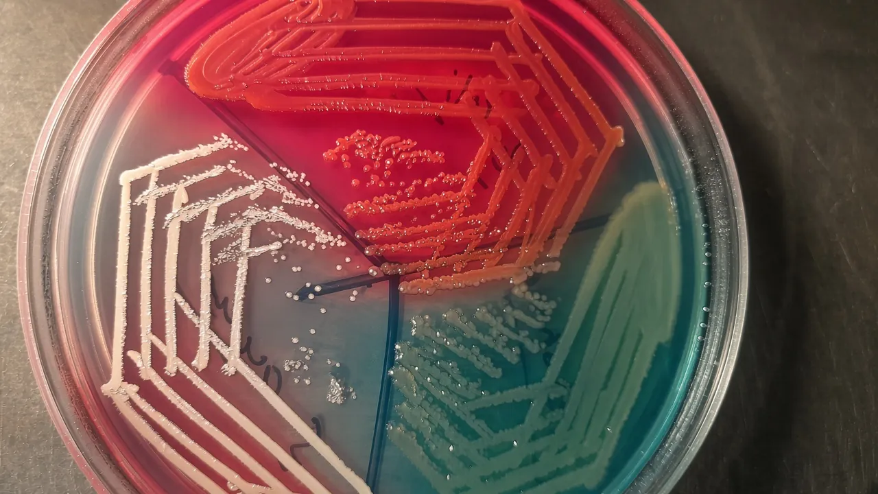 Various bacterial growth on CLED agar-E. coli (red), Pseudomonas aeruginosa (green), and Staphylococcus aureus (yellow)