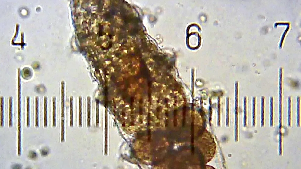TardigradeEggsInShedCuticle