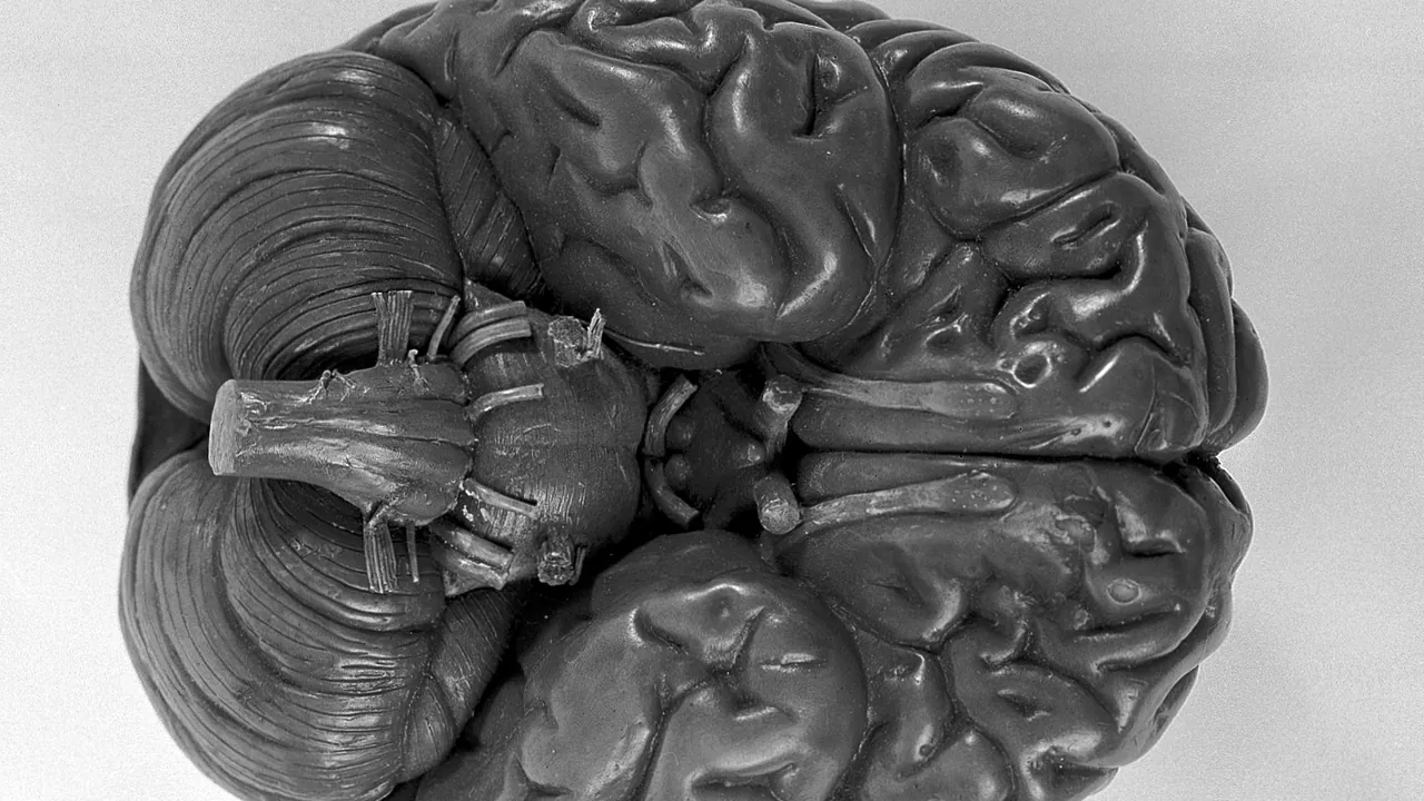 Anatomical model of human brain, Wellcome L0010009