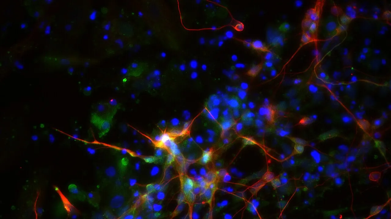 Differentiation of Human-Induced Pluripotent Stem Cells to GABAergic Neurons