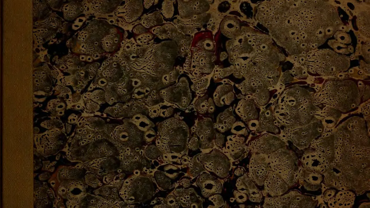 Plates illustrating the natural and morbid changes of the human eye
