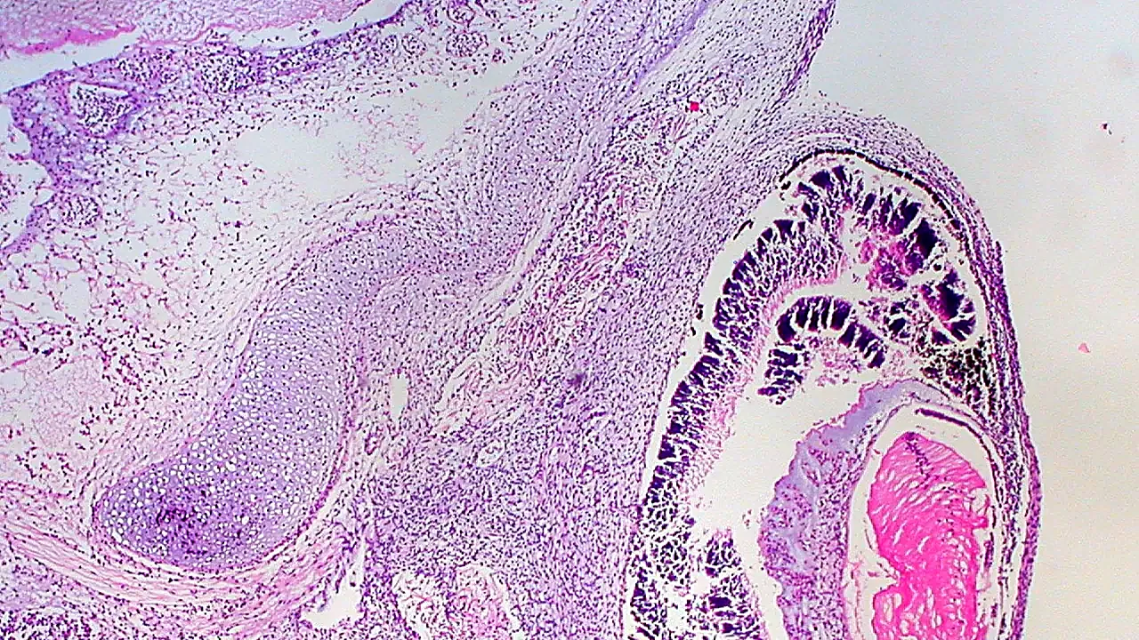 Eye and Orbit of Human Embryo (3459323897)