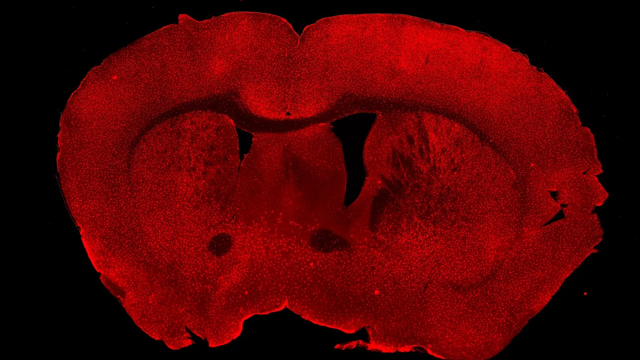 Fluorescently Labeled Microglia in a Coronal Brain Section from a C57 Mouse