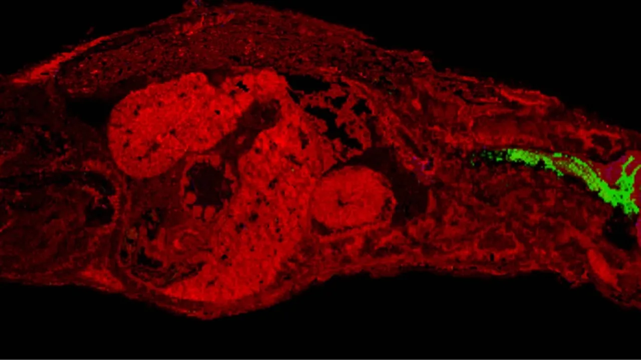 Whole body by Mass Spectrometry Imaging