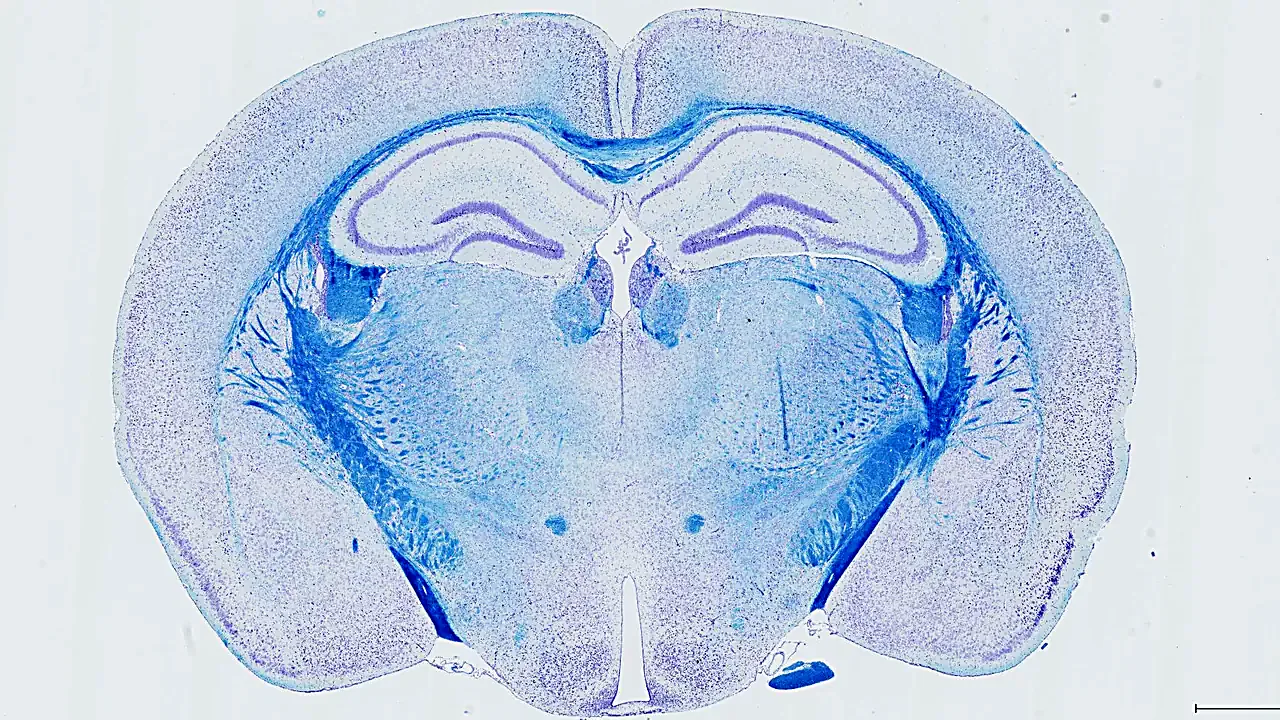 Coronal section of a mouse brain stained with Hematoxylin & LFB