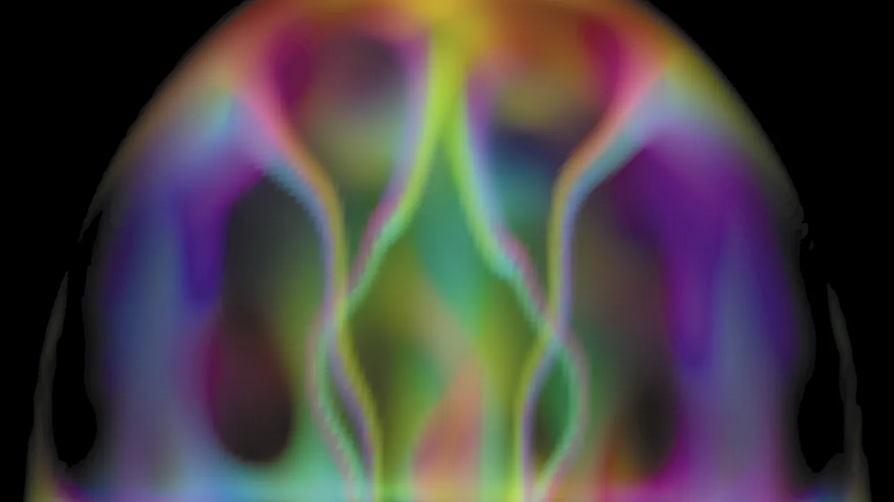 Bose-Einstein Condensate (5828204877)