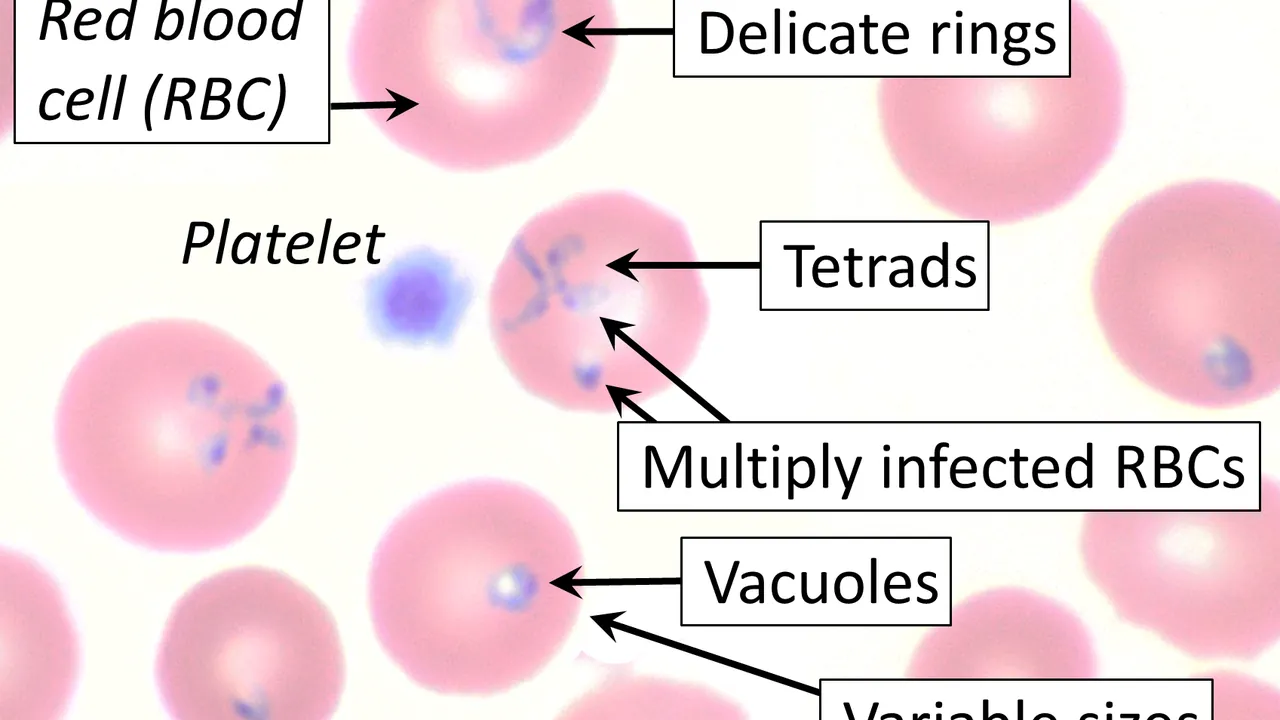 Blood smear of Babesia microti, annotated